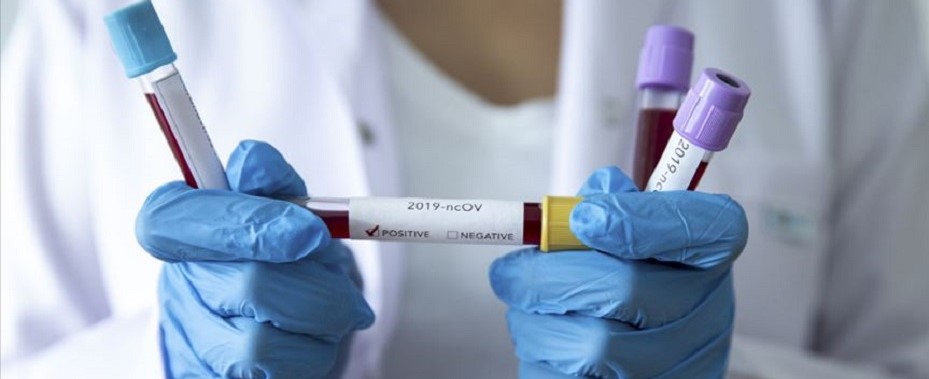 Çin'de Kovid-19 aşılarının Nisan'da klinik deneylere başlaması planlanıyor