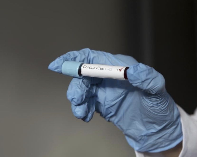 Corona virüsü yayılıyor! Güney'de vaka sayısı 10 oldu