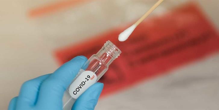 Bugünkü testlerde 83 şüpheli çıktı