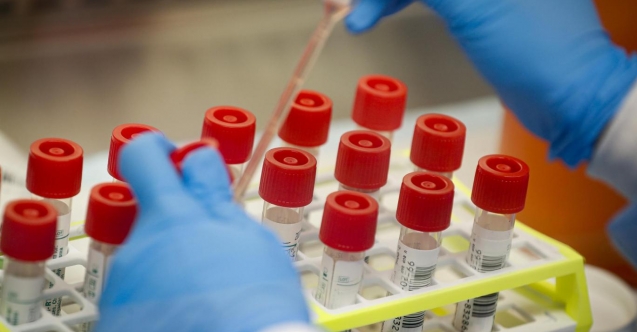 602 test yapıldı, sonuçlar açıklandı