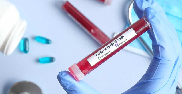 Güney'de 3 vaka daha çıktı! Biri APOEL futbolcusu