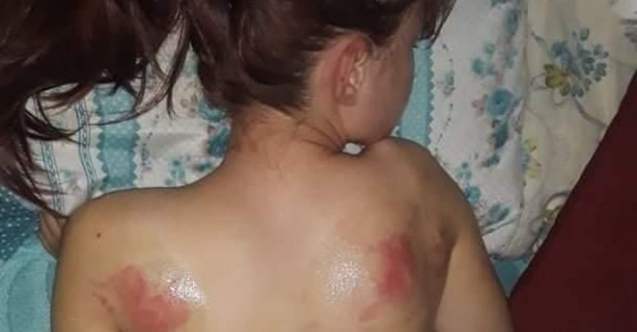 Telefon şifresini söylemeyen kızını, İngiliz anahtarıyla dövdü