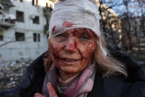 Rusya bomba yağdırıyor: Ölü sayısı 40'ı buldu