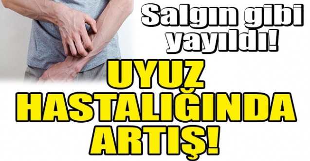 Uyuz hastalığında artış yaşanıyor