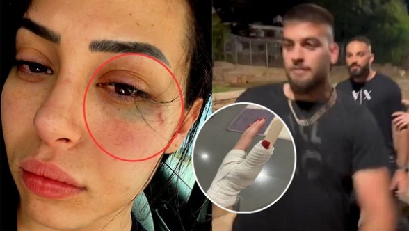 Asya'nın darp edilmesiyle ilgili Rum polisinden açıklama: "Sebebi önemsiz"