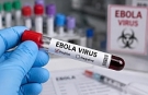 Doktorlardan Ebola salgınına karşı ulusal eylem planı çağrısı