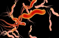 YDÜ’nün mide kanseri tespiti için geliştirdiği biyosensör patentlendi