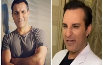 “Yakışıklılığım resmen mahvoldu”