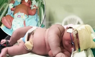 Dünyaya gelmiş en büyük bebek