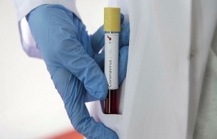 İtalya'da Kovid-19 nedeniyle ilk ölüm