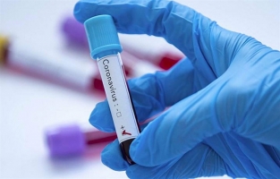 Güney Kıbrıs'taki Koronavirüs vaka sayısı 97 oldu