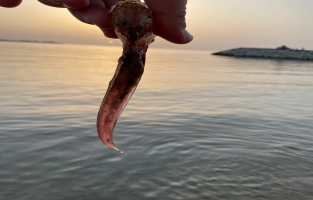 Denizanası Dokunduğunda Yapılması Gerekenler