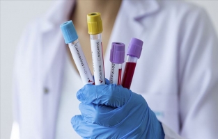 Sağlık Bakanlığı bugünkü sonuçları açıkladı: 998 test...