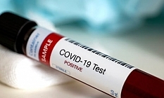 KKTC'de bugün 929 test yapıldı, 1 pozitif vakaya rastlandı