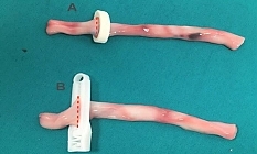 YDÜ’den yeni tasarım göbek kordonu