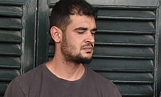 Eşi ile arkadaş oldu diye kafa atarak dişini kırdı